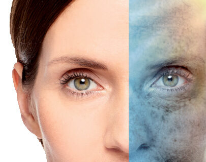 Tratamiento para el paño o melasma en el rostro
