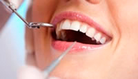 Limpieza dental